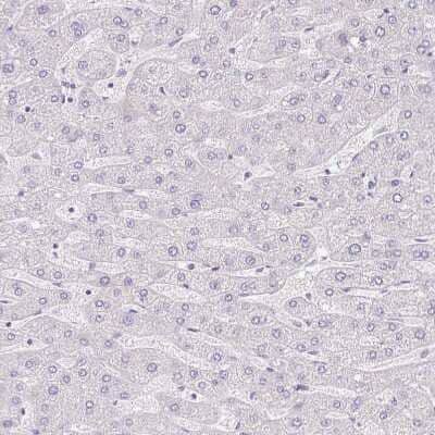 Immunohistochemistry-Paraffin: PAUF/ZG16B Antibody [NBP2-49089]