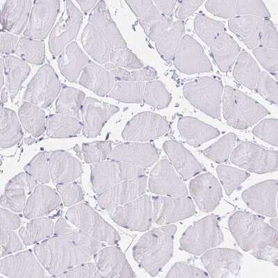 Immunohistochemistry-Paraffin: PAUF/ZG16B Antibody [NBP2-49089]