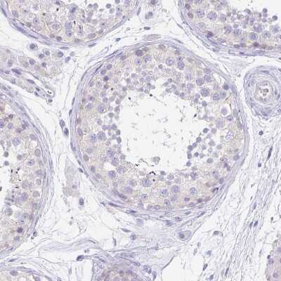 Immunohistochemistry-Paraffin: PAUF/ZG16B Antibody [NBP2-49089]