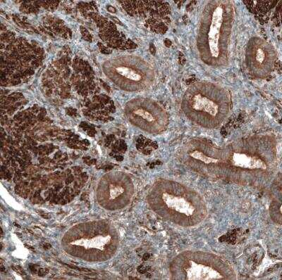 Immunohistochemistry-Paraffin: PAWR / PAR4 Antibody [NBP1-87338]