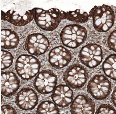 Immunohistochemistry-Paraffin: PAWR / PAR4 Antibody [NBP1-87338]