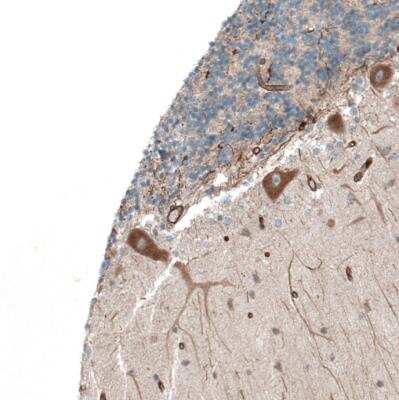 Immunohistochemistry-Paraffin: PAWR / PAR4 Antibody [NBP1-87338]