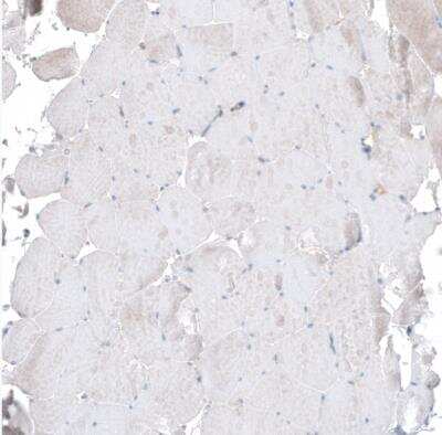 Immunohistochemistry-Paraffin: PAWR / PAR4 Antibody [NBP1-87338]