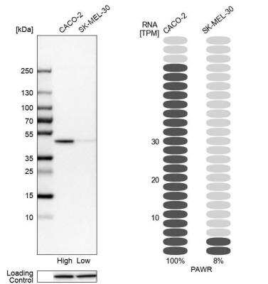 Western Blot: PAWR / PAR4 Antibody [NBP1-87338]
