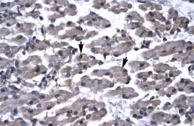 Immunohistochemistry: PAWR Antibody [NBP3-10923]