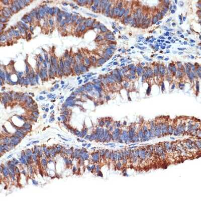 Immunohistochemistry-Paraffin: PAWR / PAR4 Antibody (10Q2G9) [NBP3-16523]