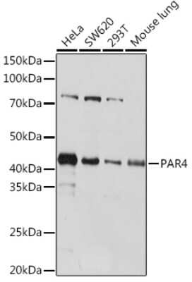 Western Blot: PAWR / PAR4 Antibody (10Q2G9) [NBP3-16523]