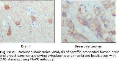 Immunohistochemistry-Paraffin: PAWR / PAR4 Antibody (3G9H7) - BSA Free [NBP1-28892]
