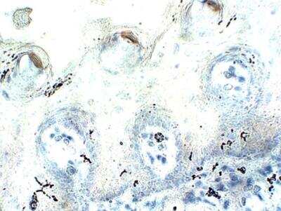 Immunohistochemistry-Paraffin: PAX1 Antibody [NBP3-12330]