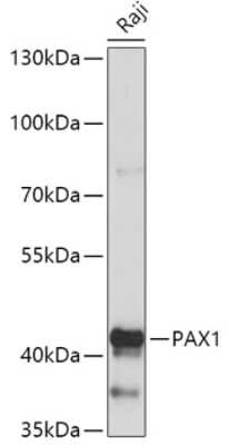 Western Blot: PAX1 AntibodyAzide and BSA Free [NBP2-93575]