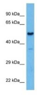 Western Blot: PAX1 Antibody [NBP3-10116]