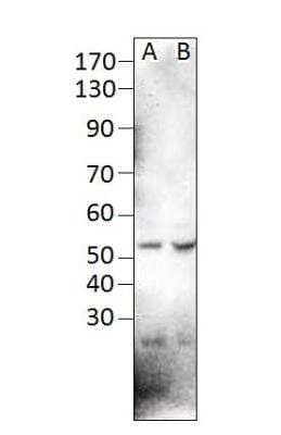 Western Blot: PAX1 Antibody [NBP3-12330]