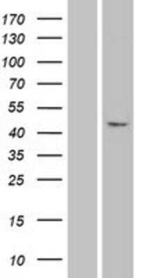 Western Blot: PAX1 Overexpression Lysate [NBP2-04309]