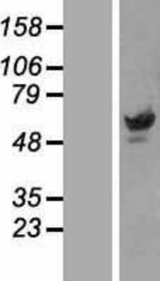 Western Blot: Pax3 Overexpression Lysate [NBP2-04926]