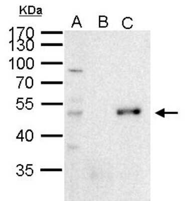 Immunoprecipitation: Pax6 Antibody [NBP2-19711]