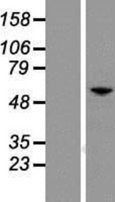 Western Blot: Pax7 Overexpression Lysate [NBP2-08096]