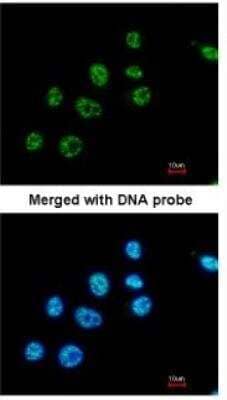 Immunocytochemistry/ Immunofluorescence: PAX8 Antibody [NBP1-32440]