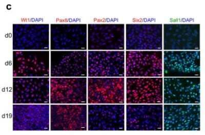 Immunocytochemistry/ Immunofluorescence: PAX8 Antibody [NBP1-32440]