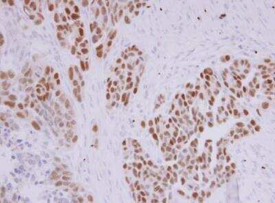 Immunohistochemistry-Paraffin: PAX8 Antibody [NBP1-32440]