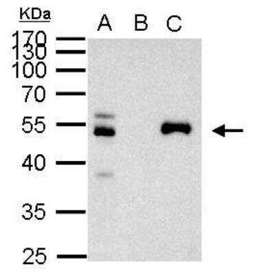 Immunoprecipitation: PAX8 Antibody [NBP1-32440]
