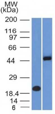 Western Blot: PAX8 Antibody (PAX8/1491 + PAX8/1492)Azide and BSA Free [NBP3-08274]