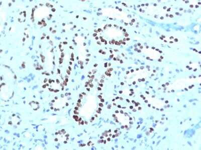 Immunohistochemistry-Paraffin: PAX8 Antibody (PAX8/1491 + PAX8/1492) [NBP3-07355]