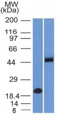 Western Blot: PAX8 Antibody (PAX8/1491 + PAX8/1492) [NBP3-07355]