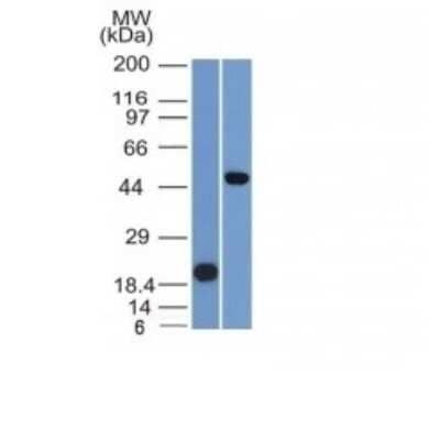 Western Blot: PAX8 Antibody (PAX8/1491)Azide and BSA Free [NBP2-54486]