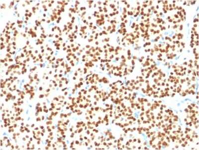 Immunohistochemistry-Paraffin: PAX8 Antibody (PAX8/1491) [NBP2-53260]