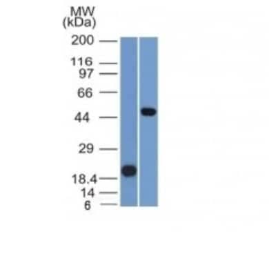 Western Blot: PAX8 Antibody (PAX8/1491) [NBP2-53260]