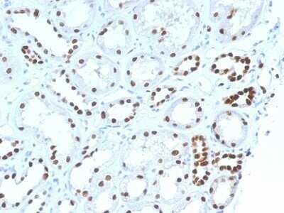 Immunohistochemistry-Paraffin: PAX8 Antibody (PAX8/1492) - Azide and BSA Free [NBP2-54539]