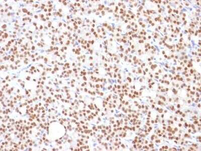 Immunohistochemistry-Paraffin: PAX8 Antibody (PAX8/1492) - Azide and BSA Free [NBP2-54539]