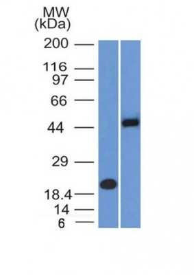 Western Blot: PAX8 Antibody (PAX8/1492)Azide and BSA Free [NBP2-54539]