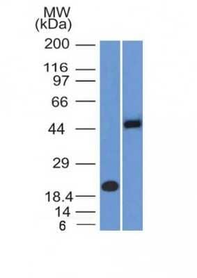 Western Blot: PAX8 Antibody (PAX8/1492) [NBP2-53371]