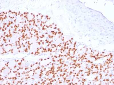Immunohistochemistry-Paraffin: PAX8 Antibody (PAX8/2774R) - Azide and BSA Free [NBP3-08275]
