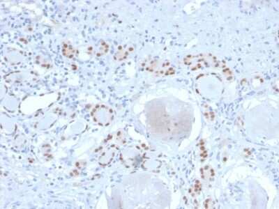 Immunohistochemistry-Paraffin: PAX8 Antibody (PAX8/2774R) [NBP3-07356]