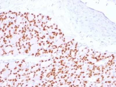 Immunohistochemistry-Paraffin: PAX8 Antibody (PAX8/2774R) [NBP3-07356]