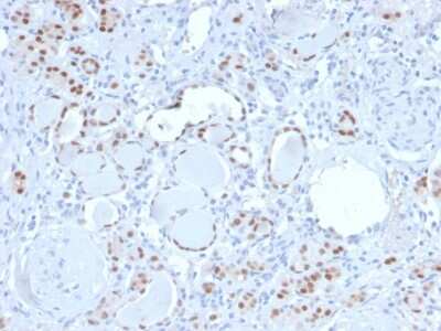 Immunohistochemistry-Paraffin: PAX8 Antibody (PAX8/3688R) - Azide and BSA Free [NBP3-08295]