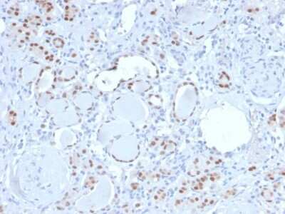 Immunohistochemistry-Paraffin: PAX8 Antibody (PAX8/3688R) [NBP3-07360]