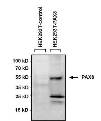 Western Blot: PAX8 Antibody [NBP2-29907]