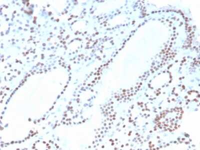 Immunohistochemistry-Paraffin: PAX8 Antibody (ZR-1) - Azide and BSA Free [NBP3-08307]