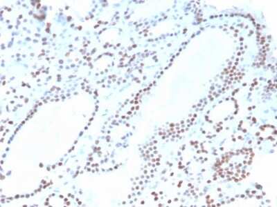 Immunohistochemistry-Paraffin: PAX8 Antibody (ZR-1) [NBP3-07361]