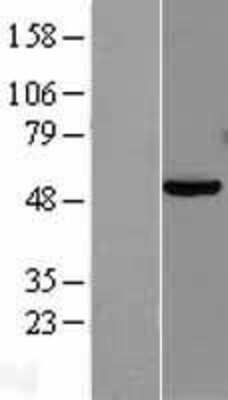 Western Blot: PAX8 Overexpression Lysate [NBL1-14132]