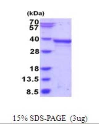 SDS-PAGE: Recombinant Human PAX8 His Protein [NBP2-51907]