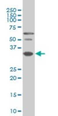 Western Blot: PAX9 Antibody (4B9) [H00005083-M03]