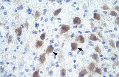 Immunohistochemistry-Paraffin: PAX9 Antibody [NBP3-10316]