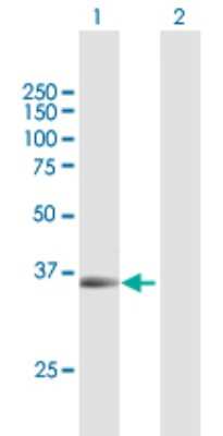 Western Blot: PAX9 Antibody [H00005083-B01P]