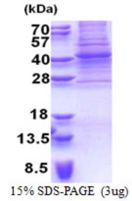 SDS-PAGE: Recombinant Human PAX9 His Protein [NBP2-23313]