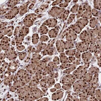 Immunohistochemistry-Paraffin: PAXX Antibody [NBP1-94172]