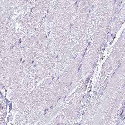 Immunohistochemistry-Paraffin: PAXX Antibody [NBP1-94172]